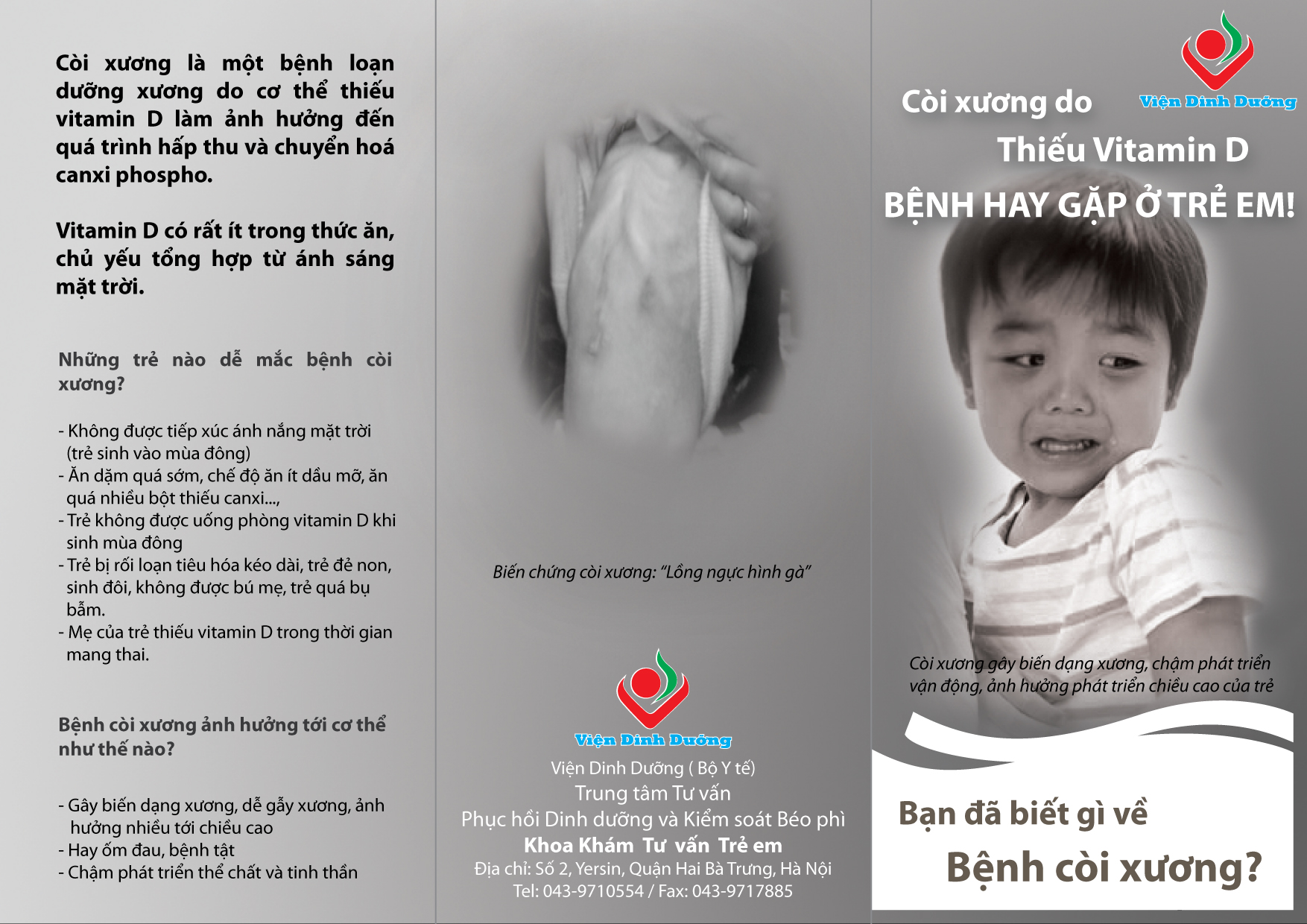 Tờ rơi Bạn biết gì về bệnh còi xương